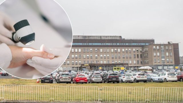 Awaited Dermatologist Position at LUH Progresses Slowly: What’s Next?